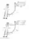 Fig. 10 - Rod insertion tools, rods and methods