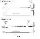 Fig. 04 - Methods and systems for achieving a physiological response by pudendal nerve stimulation and blockade