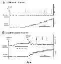 Fig. 07 - Methods and systems for achieving a physiological response by pudendal nerve stimulation and blockade
