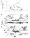Fig. 30 - Methods and systems for achieving a physiological response by pudendal nerve stimulation and blockade