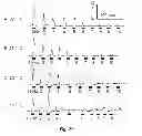 Fig. 31 - Methods and systems for achieving a physiological response by pudendal nerve stimulation and blockade