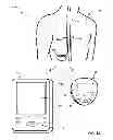 Fig. 02 - Collecting gait information for evaluation and control of therapy