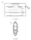 Fig. 02 - Systems and methods for wireless control of noninvasive electrotherapy