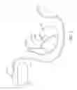 Fig. 02 - METHOD FOR DETECTING AND TREATING VENTRICULAR ARRHYTHMIA