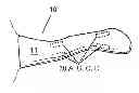 Fig. 01 - Devices for vestibular or cranial nerve stimulation