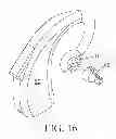 Fig. 08 - Devices for vestibular or cranial nerve stimulation