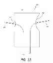 Fig. 16 - Apparatus and method of placement of a graft or graft system