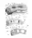 Fig. 06 - Articulating expandable intervertebral implant