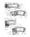 Fig. 08 - Articulating expandable intervertebral implant