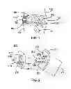 Fig. 02 - System and method for installing an annular repair rivet through a vertebral body port
