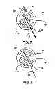 Fig. 06 - System and method for installing an annular repair rivet through a vertebral body port