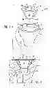 Fig. 02 - Prosthetic implant support structure