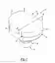 Fig. 02 - Method of using a modular glenoid prosthesis