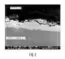 Fig. 03 - Cobalt chrome coated titanium implant