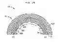 Fig. 21 - Laser-produced porous surface