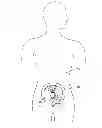 Fig. 01 - Implantable digestive tract organ