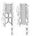 Fig. 11 - Implantable digestive tract organ