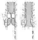 Fig. 12 - Implantable digestive tract organ