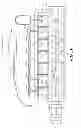 Fig. 14 - Implantable digestive tract organ