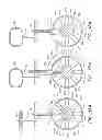 Fig. 15 - Implantable digestive tract organ