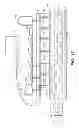 Fig. 16 - Implantable digestive tract organ