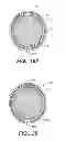 Fig. 20 - Implantable digestive tract organ