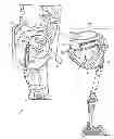 Fig. 01 - PROSTHETIC LIMB ATTACHMENT SYSTEM