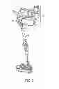 Fig. 04 - PROSTHETIC LIMB ATTACHMENT SYSTEM
