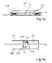Fig. 09 - Steering damper with active adjustment of damping characteristics