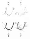 Fig. 09 - Method and system for patient-specific modeling of blood flow