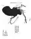 Fig. 13 - Method and system for patient-specific modeling of blood flow