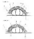 Fig. 03 - Bed cover
