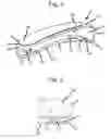 Fig. 02 - DEVICE FOR SECURING AN ARTICLE OF CLOTHING