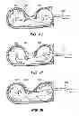 Fig. 83 - HUMANOID ROBOTICS SYSTEM AND METHODS