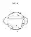 Fig. 04 - Dual lumen storage and waste container