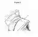 Fig. 07 - Dual lumen storage and waste container