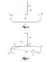 Fig. 02 - Reinforced plug