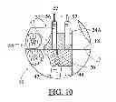 Fig. 08 - Endless clip-strip feed splicer