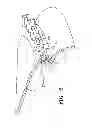 Fig. 07 - Composite bead plate and an air spring using the same