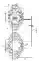 Fig. 09 - Armature winding of rotating electrical machine