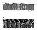 Fig. 07 - Automatic spinal canal segmentation using cascaded random walks