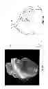 Fig. 02 - Method and a system for registering a 3D pre-acquired image coordinate system with a medical positioning system coordinate system and with a 2D image coordinate system