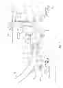 Fig. 03 - Gas turbine engine diffuser system for a high pressure (HP) compressor