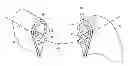 Fig. 01 - Removable rotor blade tip