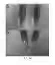Fig. 29 - Polyphosphate-functionalized inorganic nanoparticles as hemostatic compositions and methods of use
