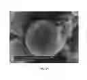Fig. 33 - Polyphosphate-functionalized inorganic nanoparticles as hemostatic compositions and methods of use
