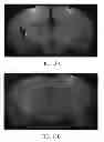 Fig. 15 - Methods of treating cognitive impairment