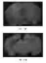 Fig. 16 - Methods of treating cognitive impairment