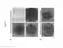 Fig. 44 - Methods, kits, and compositions for stem cell self-renewal