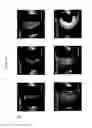 Fig. 52 - Methods, kits, and compositions for stem cell self-renewal